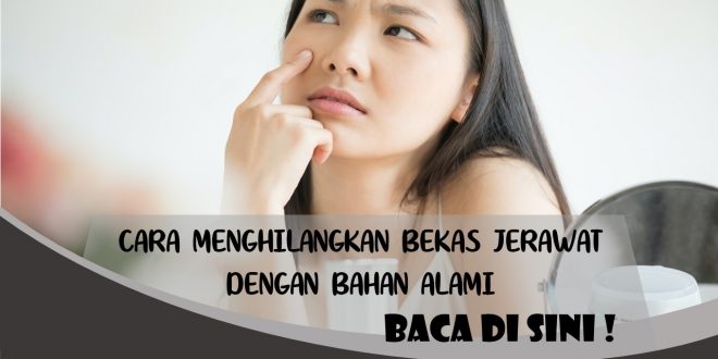 CARA MENGHILANGKAN BEKAS JERAWAT