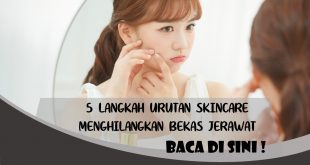 LANGKAH SKINCARE MENGHILANGKAN BEKAS JERAWAT