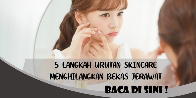 LANGKAH SKINCARE MENGHILANGKAN BEKAS JERAWAT