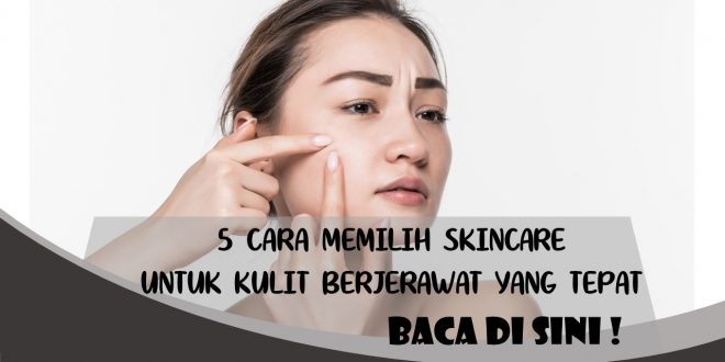 CARA MEMILIH SKINCARE UNTUK KULIT BERJERAWAT