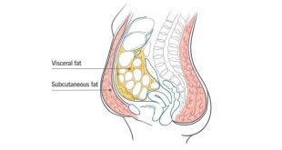 Get rid of lower belly fat