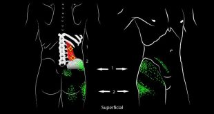 Workout for lower back pain