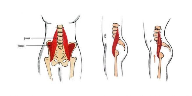 Anterior pelvic tilt